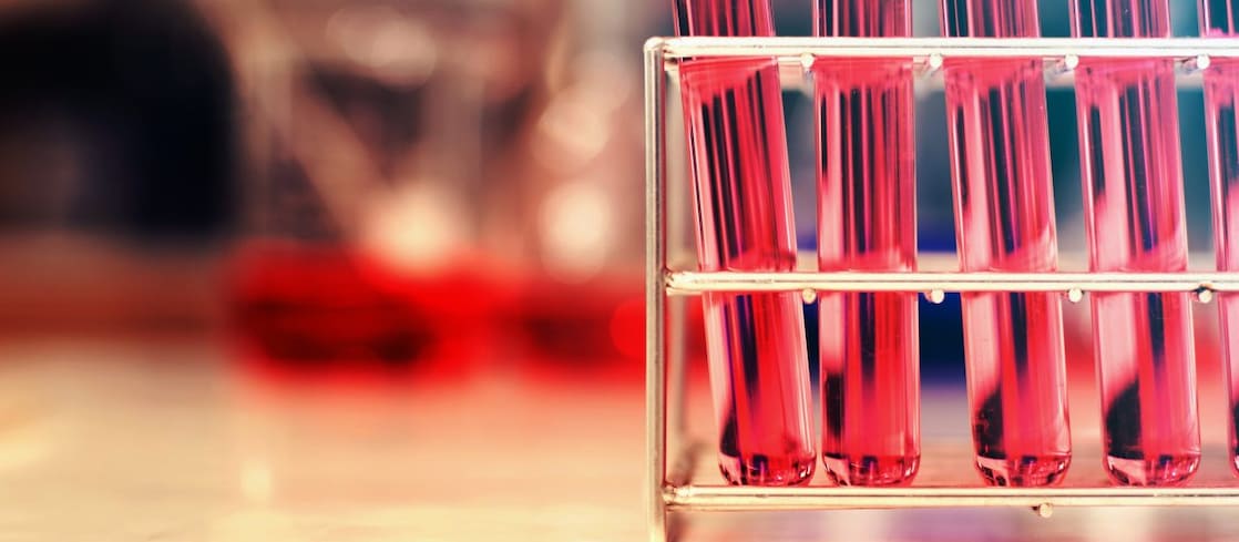 Mehrere rote Flüssigkeiten in Reagenzgläsern, die sich wiederrum in einer Halterung befinden.