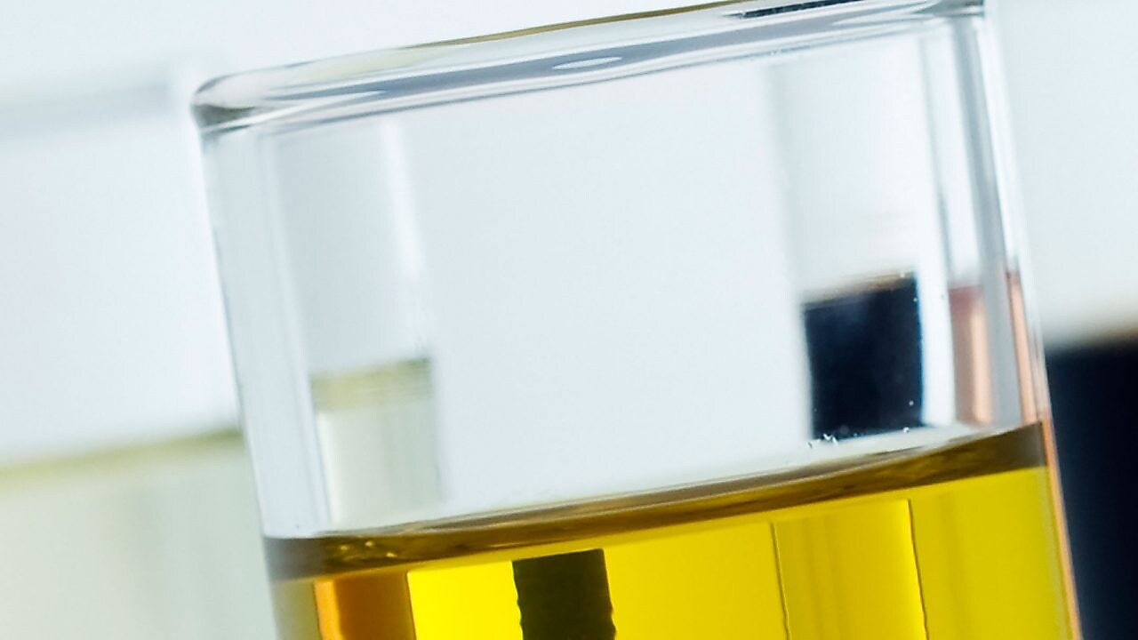 Reagenzgläser mit Öl